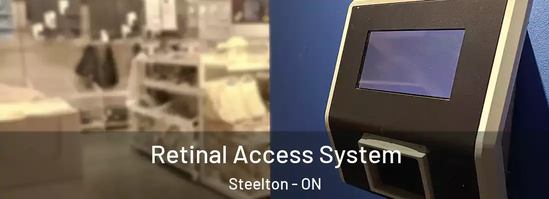  Retinal Access System Steelton - ON